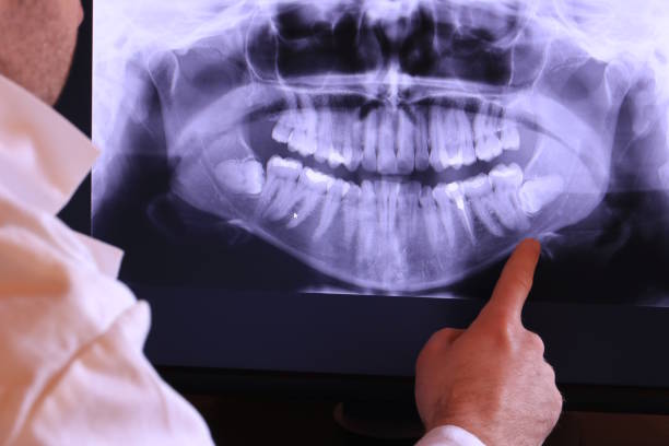 Best Pediatric Emergency Dentist in Berwick, LA