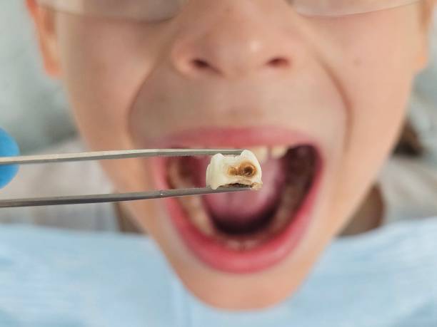 Best Emergency Dental Care for Trauma or Injury in Berwick, LA