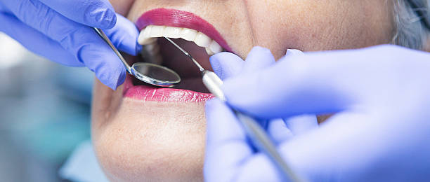 Best Emergency Tooth Extraction in Berwick, LA